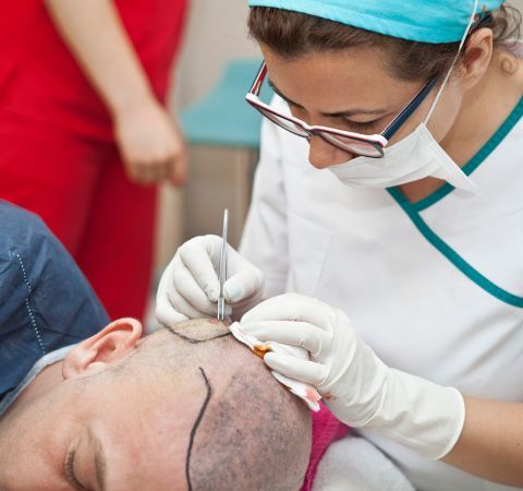 Top Countries for Low-Cost Hair Transplantation for Americans